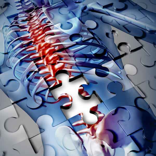 Imagen: Curso internacional en intervención de terapia ocupacional en el paciente con lesión medular