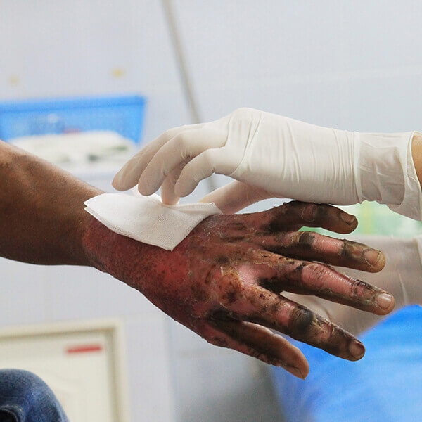 Imagen: Curso internacional de manejo del paciente quemado crítico