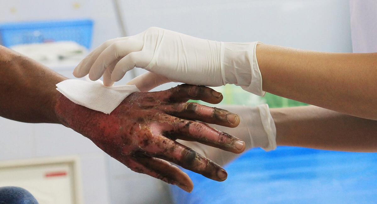 Foto de: Curso internacional de manejo del paciente quemado crítico