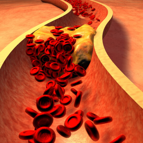 Imagen: Experto internacional en cuidados enfermeros críticos cardiovasculares