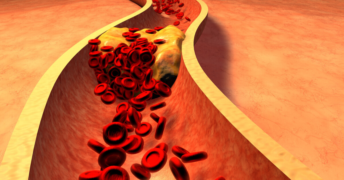 Foto de: Experto internacional en cuidados enfermeros críticos cardiovasculares